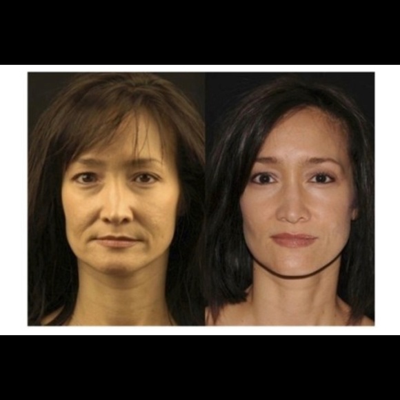 [NIB] Nuskin facial spa + conductive gel - Picture 2 of 9